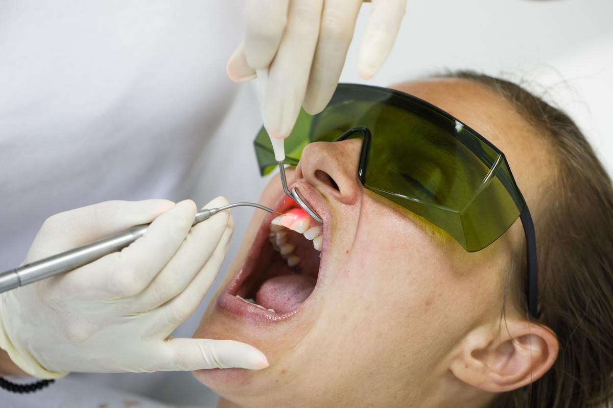 Laser therapy for dentinal hypersensitivity  Cochrane Oral Health